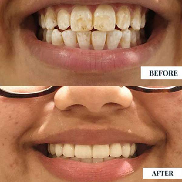 Best Smile Design Doctor in Rajarhat